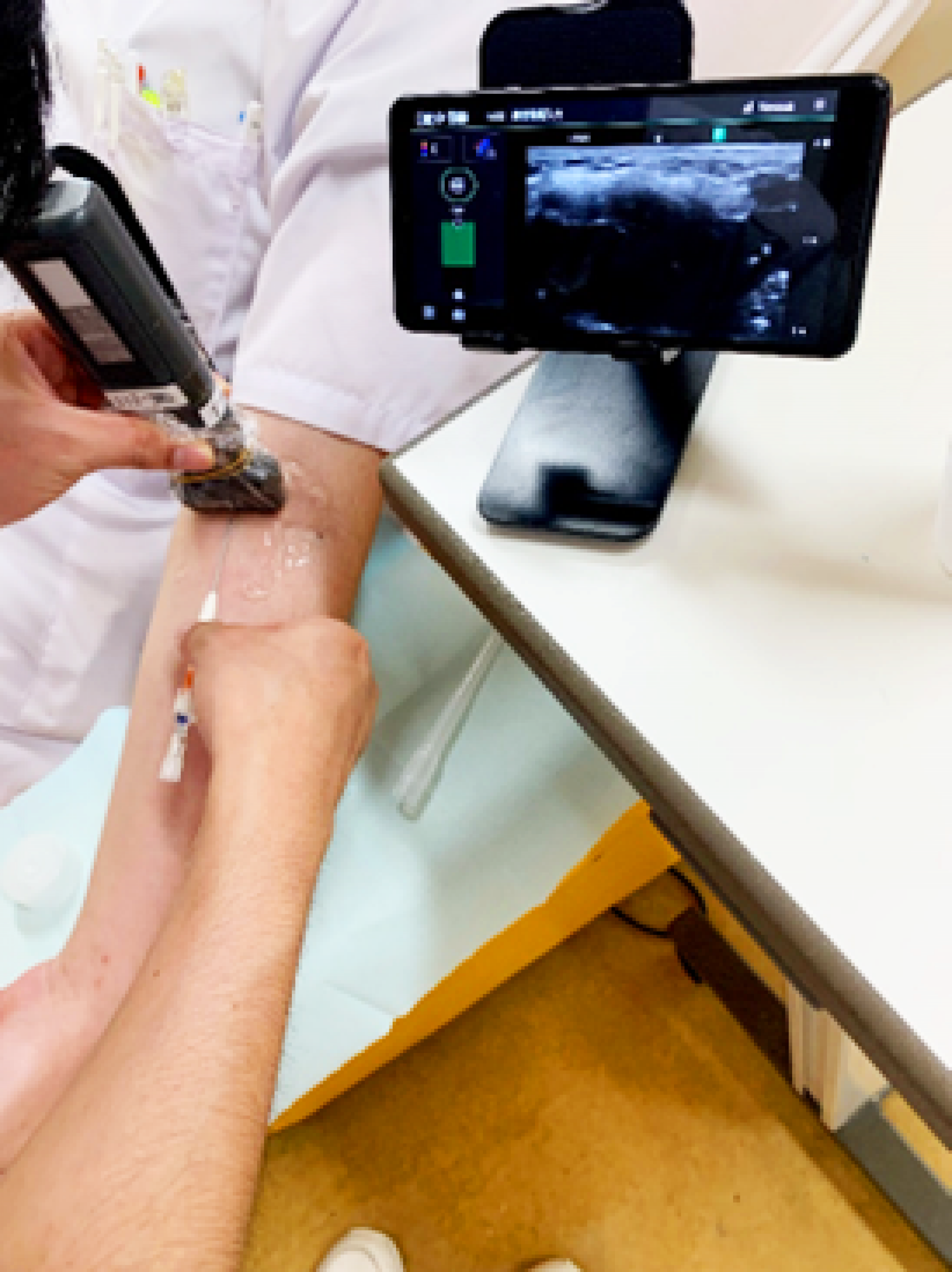 ポータブルエコー下穿刺の様子